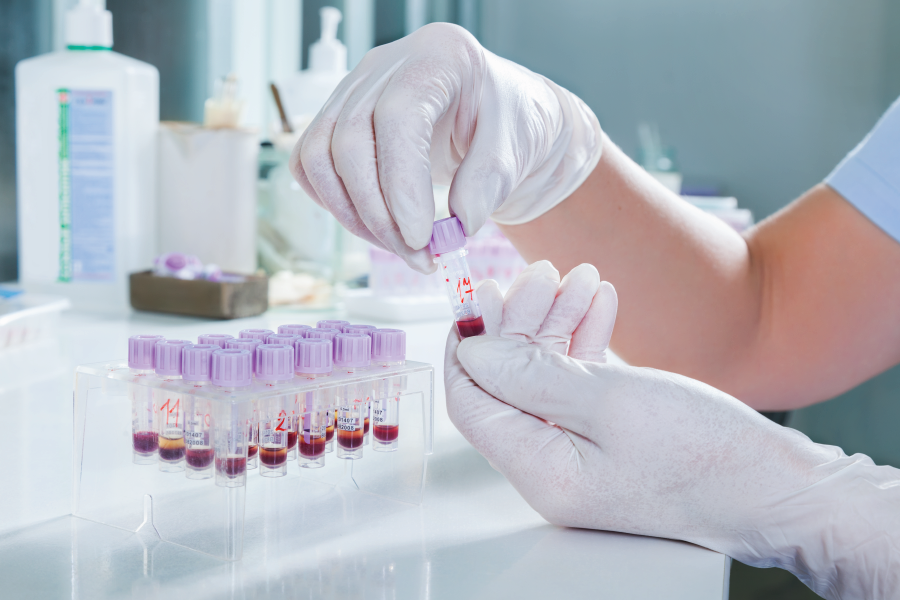 Cultura secretie col - identificare bacteriana si fungica
