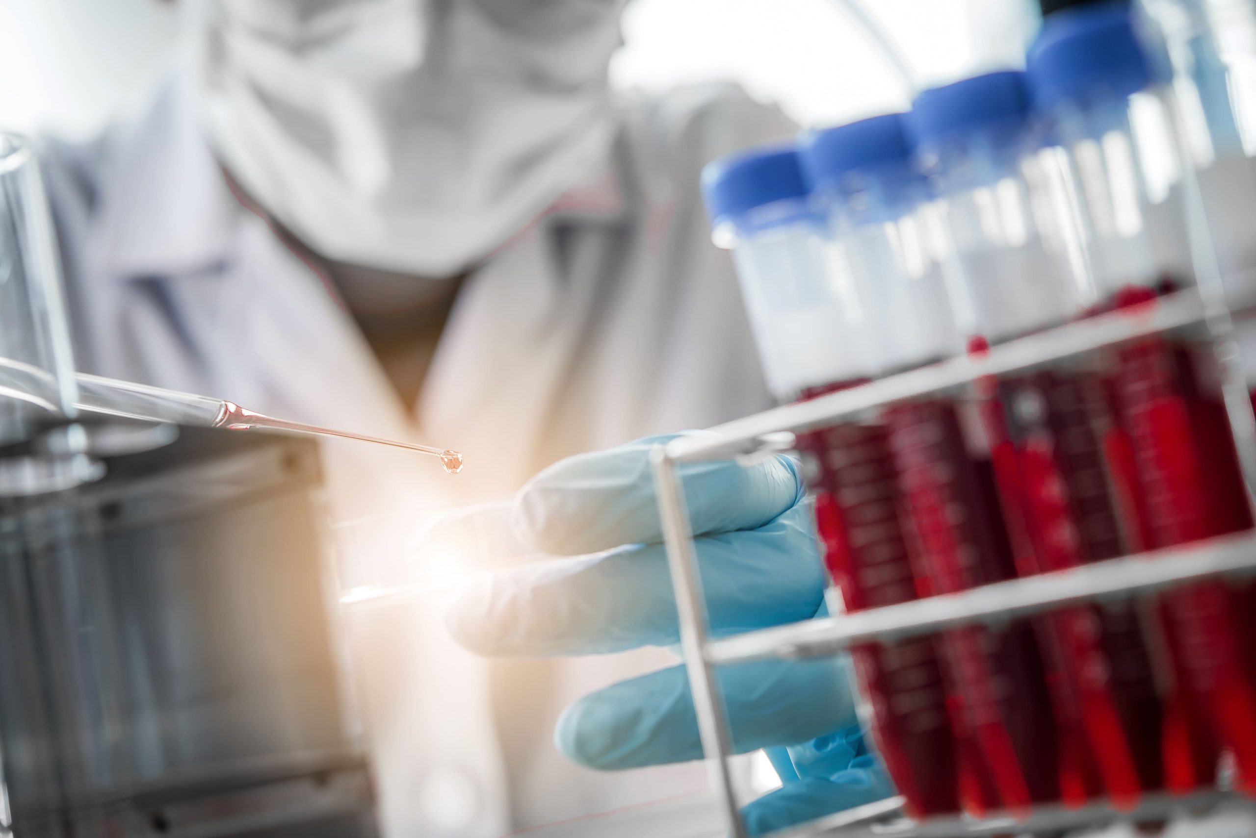 Lab technician wearing gloves and a lab coat uses a pipette beside a rack of red-capped tubes in a lab setting.