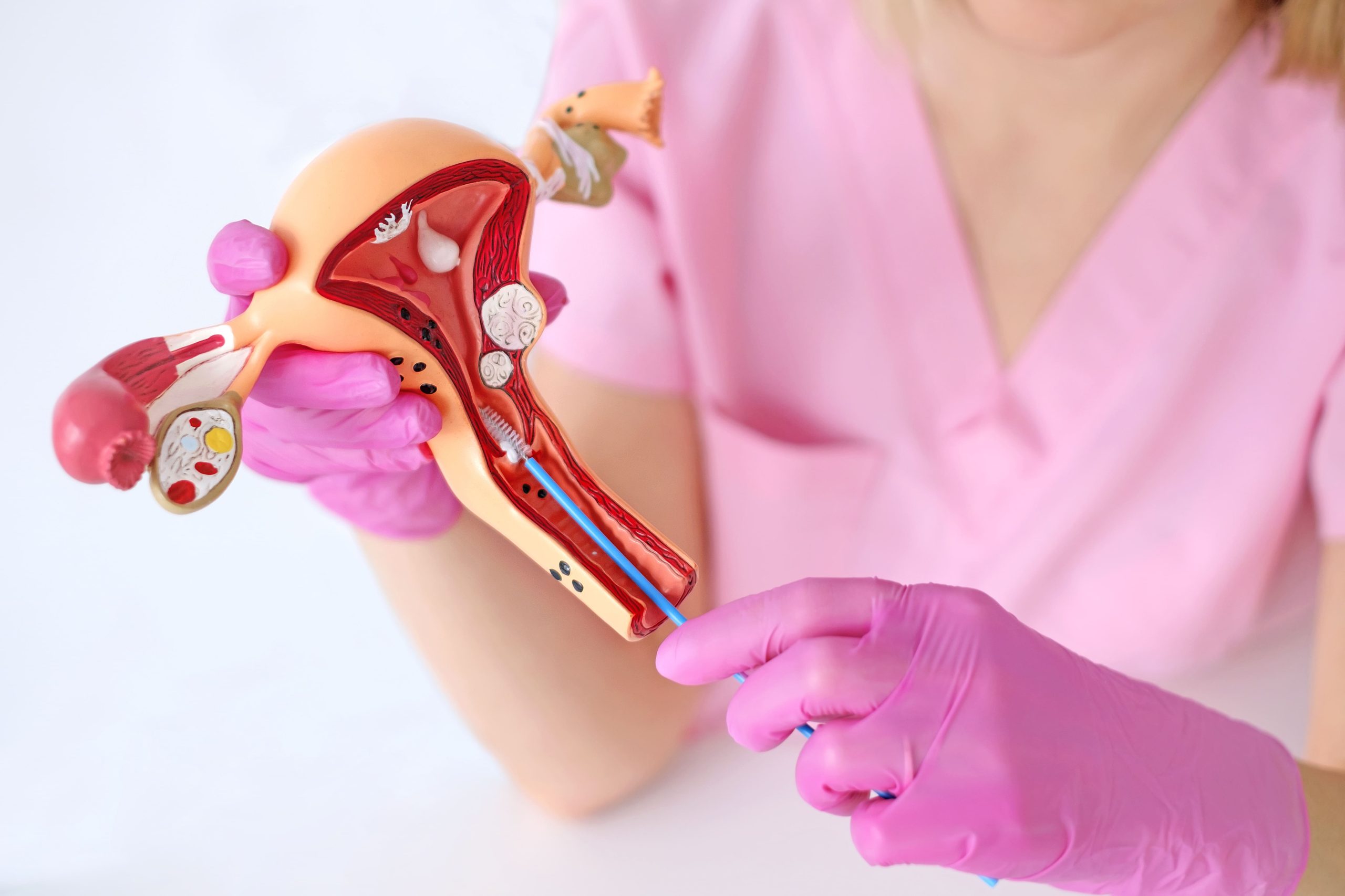 Testare Babeș-Papanicolau în mediu lichid - Clinica Sante