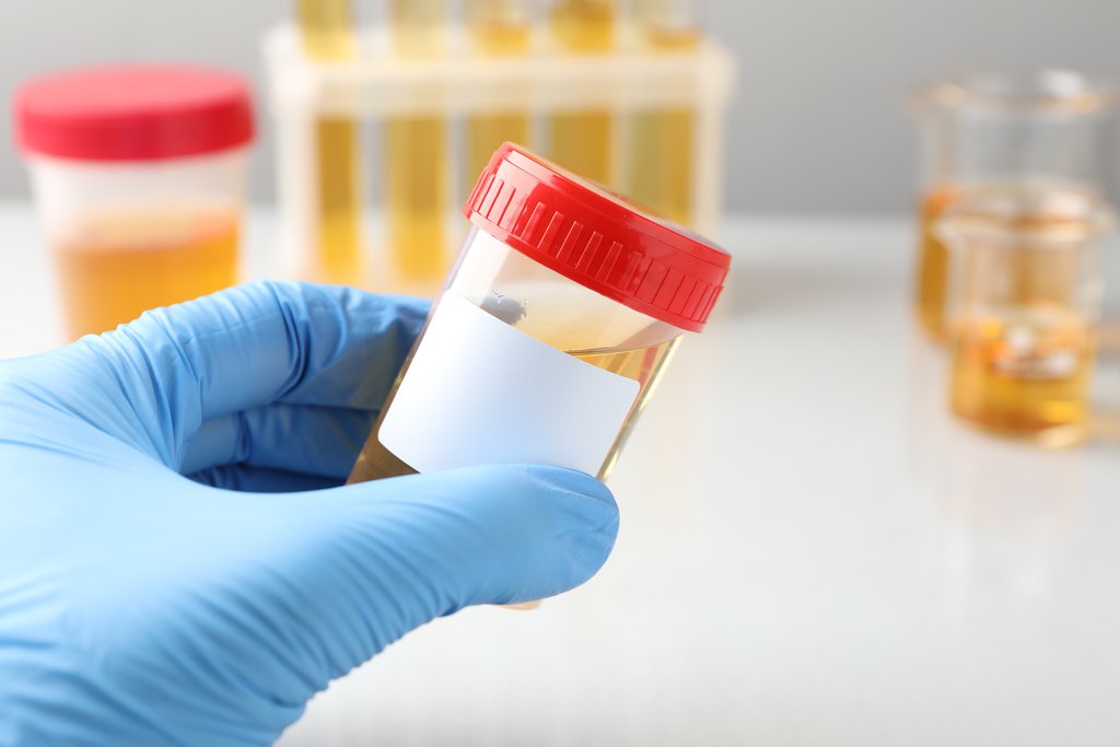 Recipient de colectare a urinei pe 24 de ore, folosit pentru analiza de melatonină